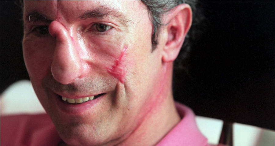 Everest Disaster Doctor on Climber’s Miraculous Survival